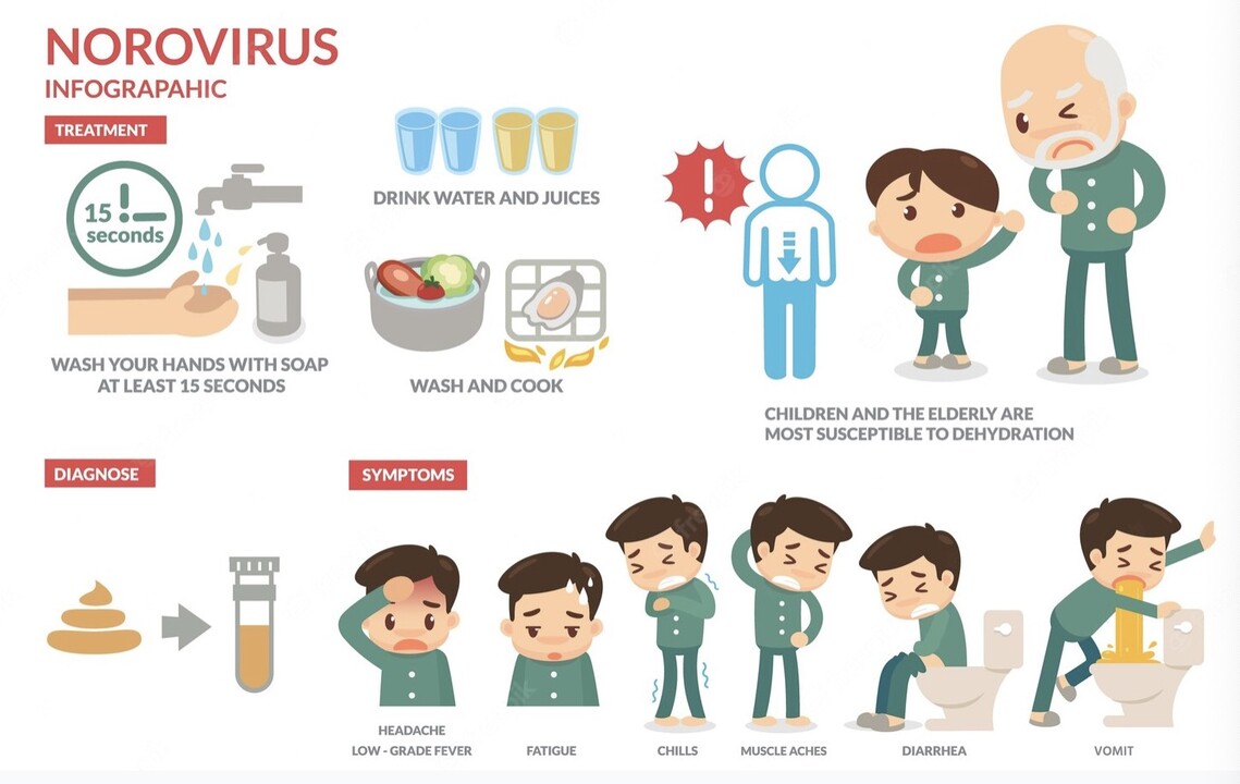 Norovirus Symptoms and Treatment